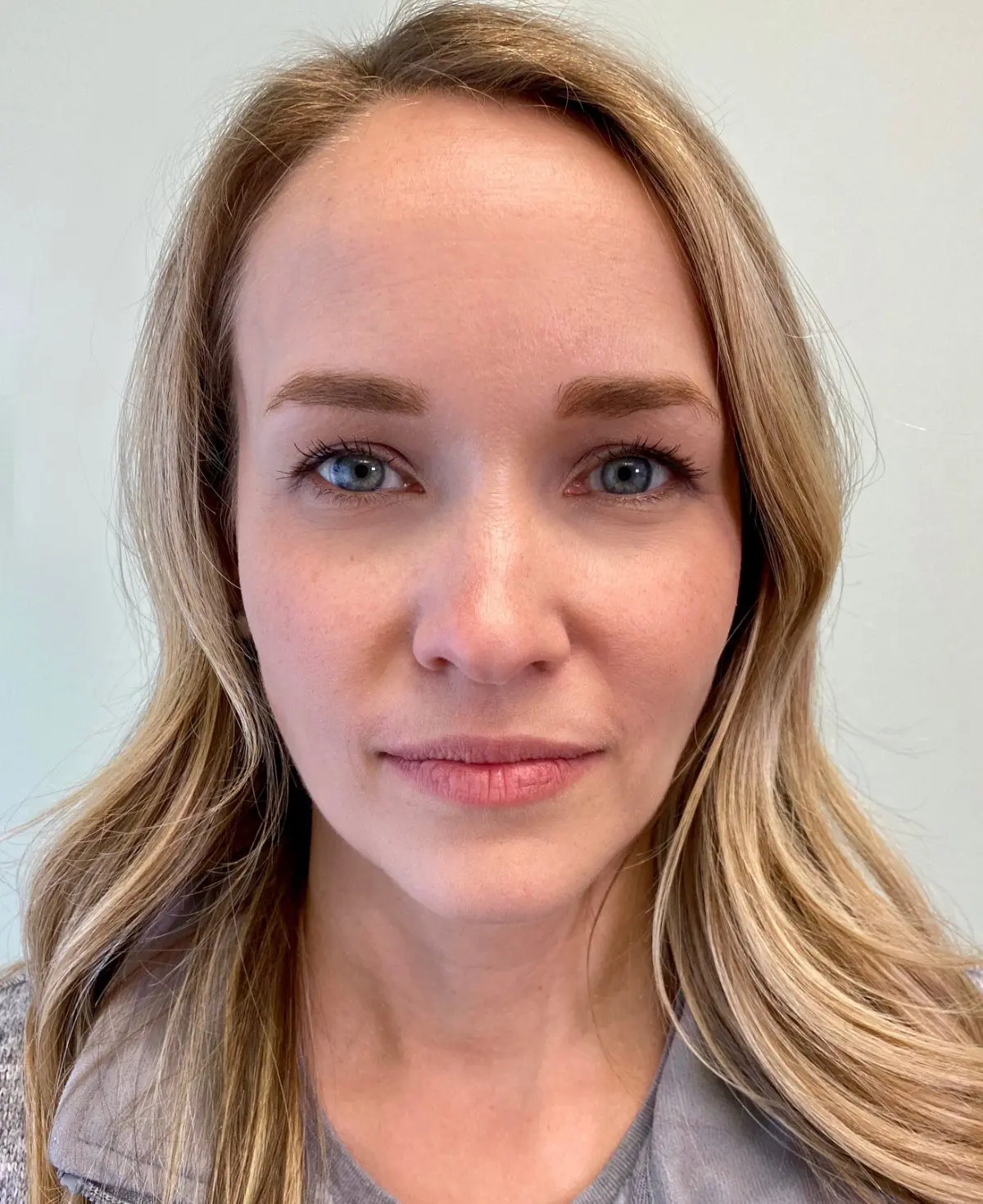 A woman with long blonde hair and blue eyes, showcasing her radiant smile perfected by Freelove Orthodontics, looks directly at the camera against a plain background in Kent and Sammamish, WA
