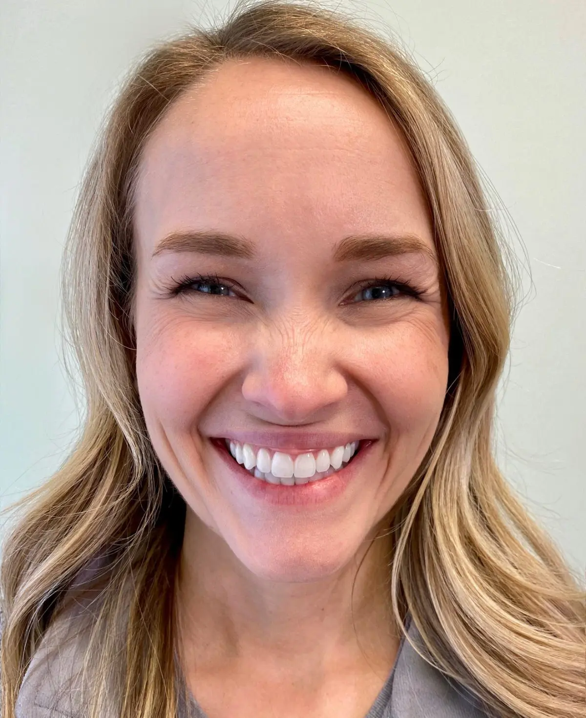 A woman with long blonde hair smiles broadly in a close-up portrait. She is wearing a light-colored jacket and has bright eyes and clear skin, reflecting the confidence that comes from her perfect smile, thanks to Freelove Orthodontics in Kent and Sammamish, WA