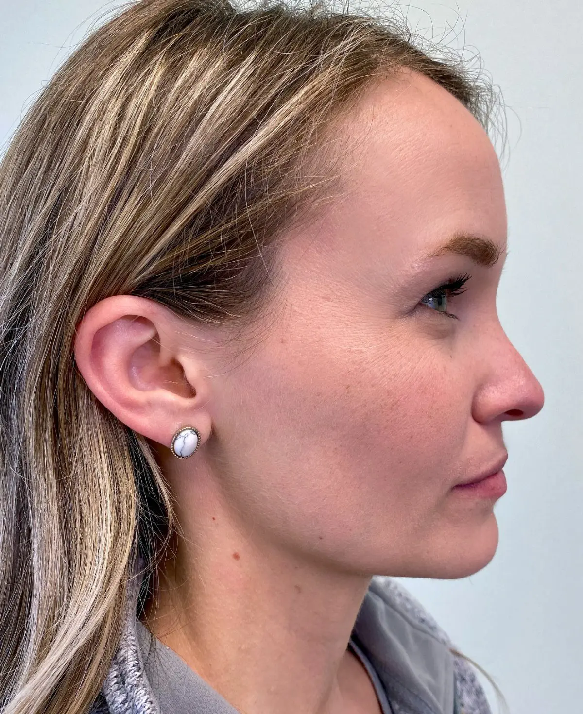 Profile of a person with long hair, wearing a jacket and stud earrings from Freelove Orthodontics, looking to the right in Kent and Sammamish, WA
