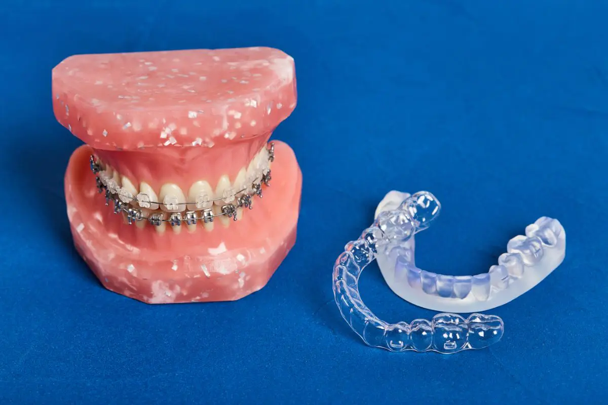 Best Orthodontic Treatment Option at Freelove Orthodontics
