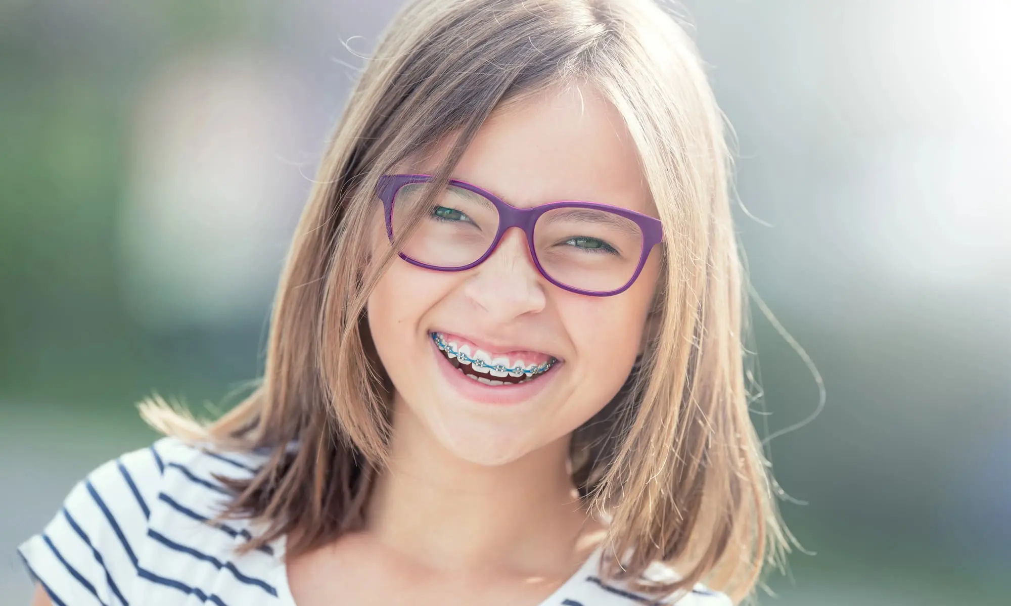 A smiling girl with glasses and metal braces, wearing a striped shirt, stands outdoors at Freelove Orthodontics, orthodontist in Sammamish and Kent, WA