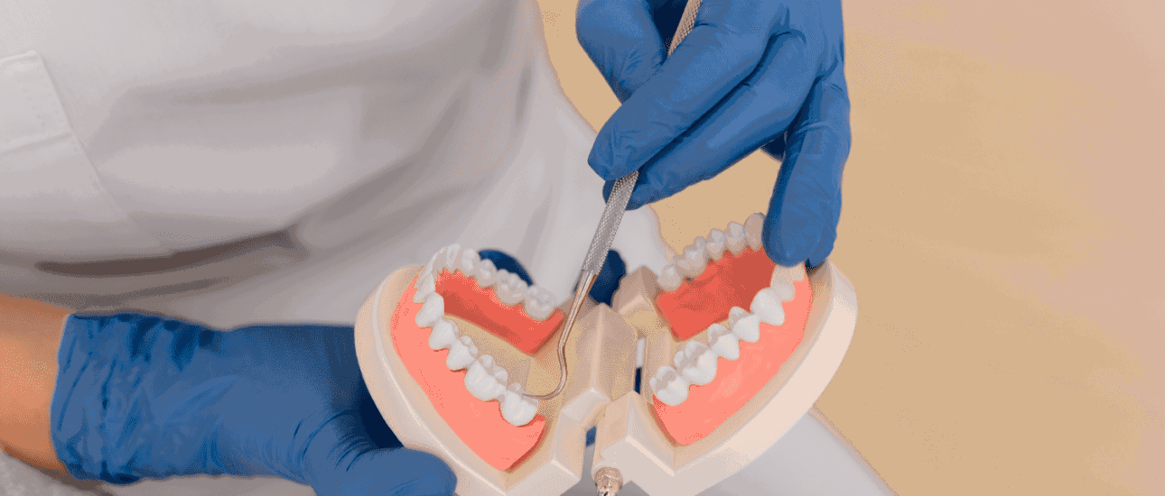 A person wearing blue gloves uses a dental tool on a set of dental model teeth in Sammamish or Kent, WA.