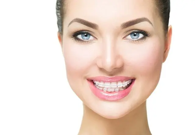 A woman in Kent, WA, is smiling with clear braces on her teeth against a white background.