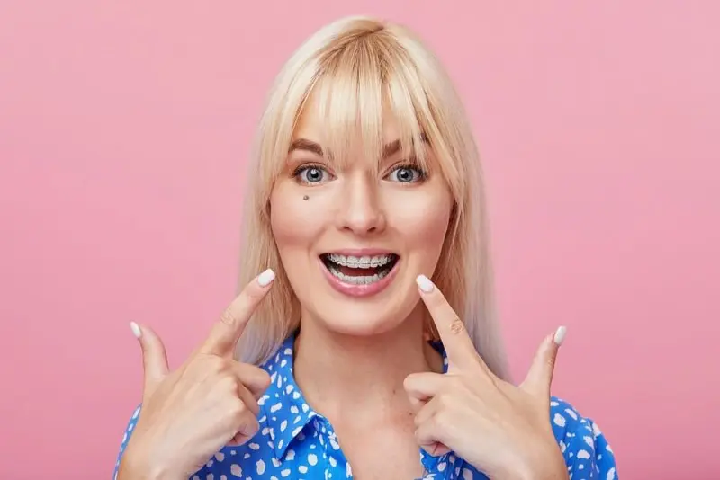 Woman with blonde hair wearing ceramic clear braces, joyfully smiling and pointing to her braces with both hands against a pink background. She is dressed in a blue polka dot shirt, showcasing her style and confidence in Sammamish, WA.