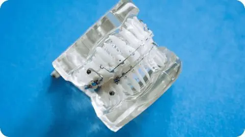 Clear dental retainer and Metal Braces in Kent Sammamish, WA with metal wires placed on a blue surface.