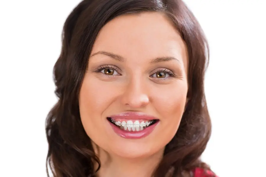 A woman with brown hair smiles warmly, showcasing her clear braces against a white background.
